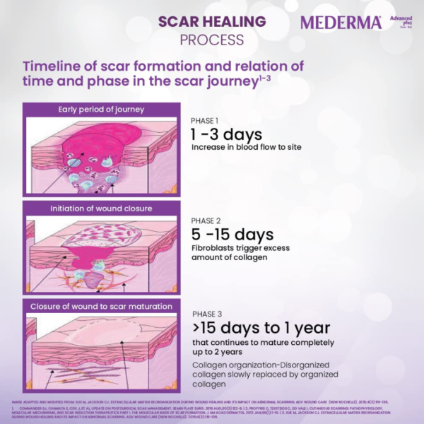 Mederma Advance Plus Scar Gel – Dermatologist-Recommended Scar Treatment - Image 5